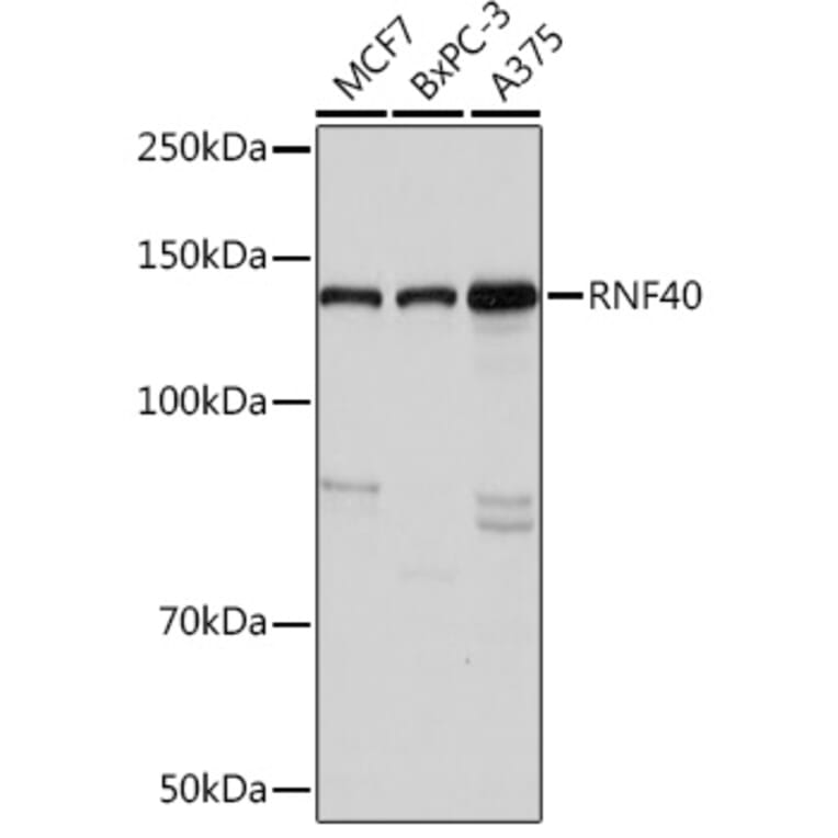 Western Blot - Anti-RNF40 Antibody [ARC1651] (A308431) - Antibodies.com