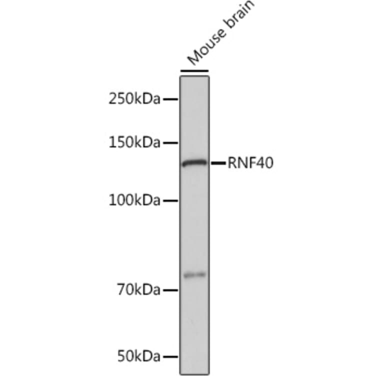 Western Blot - Anti-RNF40 Antibody [ARC1651] (A308431) - Antibodies.com