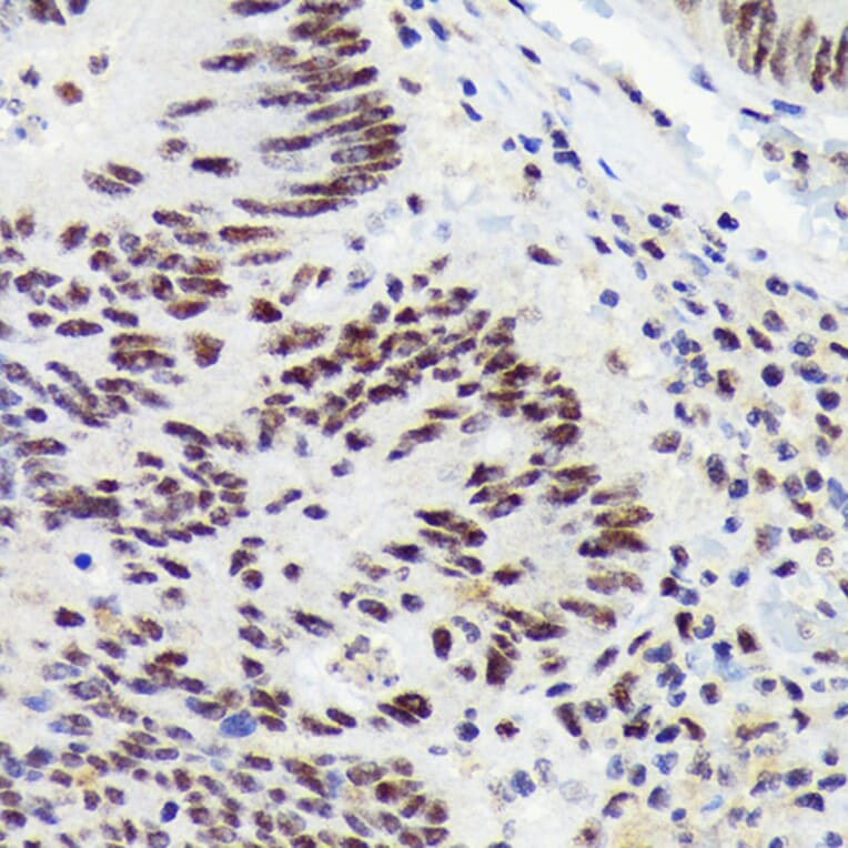 Immunohistochemistry - Anti-RNF40 Antibody [ARC1651] (A308431) - Antibodies.com