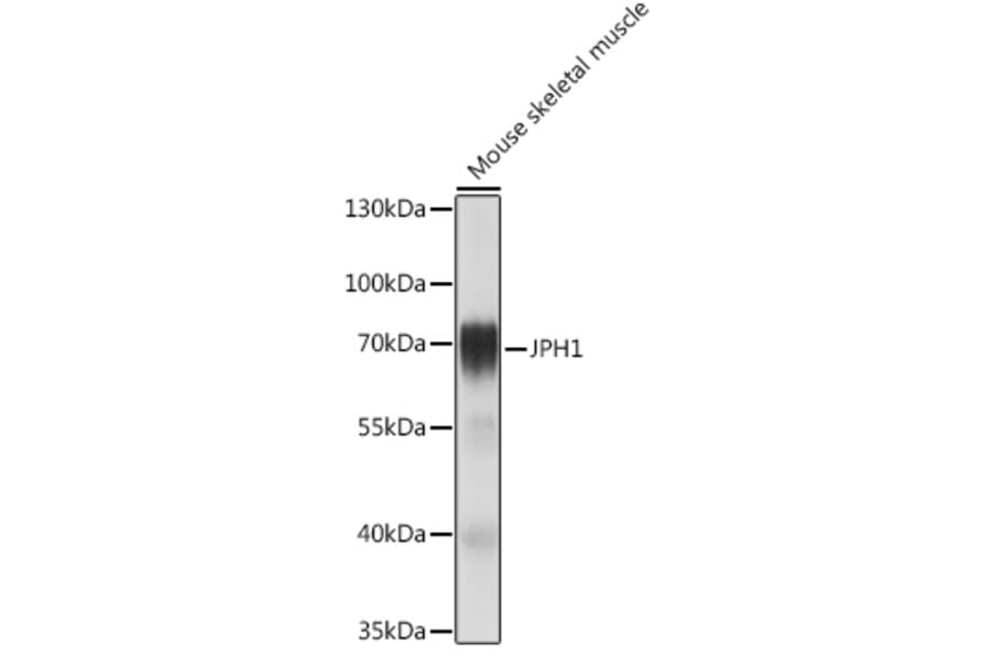 Western Blot - Anti-JP-1 Antibody (A308432) - Antibodies.com