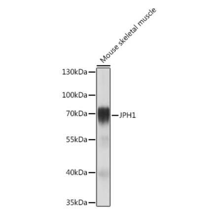 Western Blot - Anti-JP-1 Antibody (A308432) - Antibodies.com