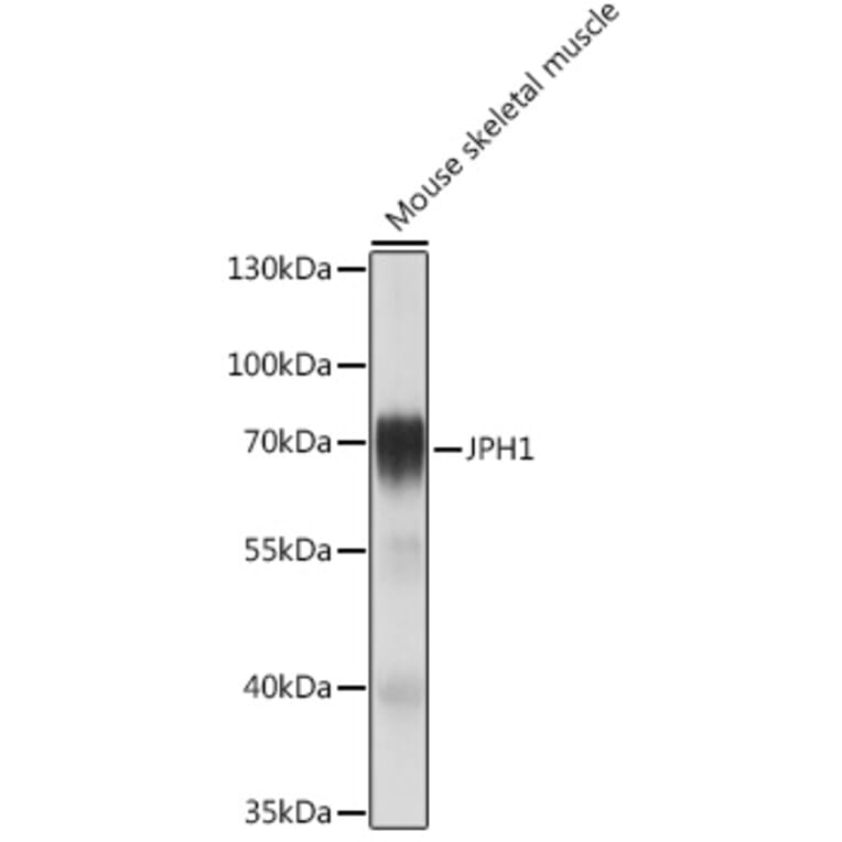 Western Blot - Anti-JP-1 Antibody (A308432) - Antibodies.com