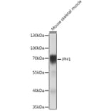 Western Blot - Anti-JP-1 Antibody (A308432) - Antibodies.com