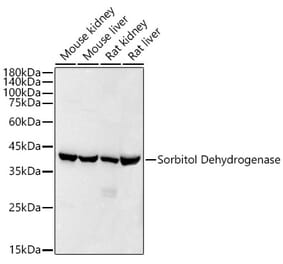 Western Blot - Anti-Sorbitol Dehydrogenase Antibody [ARC53945] (A308433) - Antibodies.com