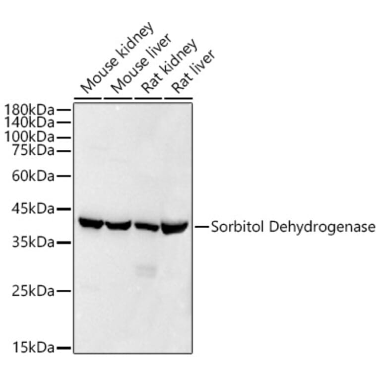 Western Blot - Anti-Sorbitol Dehydrogenase Antibody [ARC53945] (A308433) - Antibodies.com