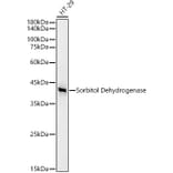 Western Blot - Anti-Sorbitol Dehydrogenase Antibody [ARC53945] (A308433) - Antibodies.com