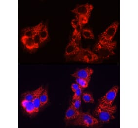 Immunofluorescence - Anti-Sorbitol Dehydrogenase Antibody (A308434) - Antibodies.com