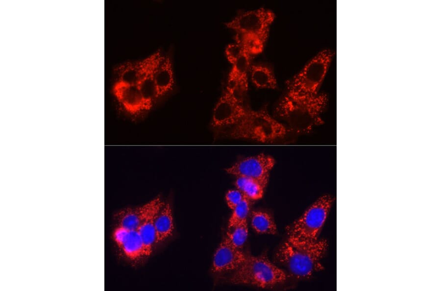 Immunofluorescence - Anti-Sorbitol Dehydrogenase Antibody (A308434) - Antibodies.com