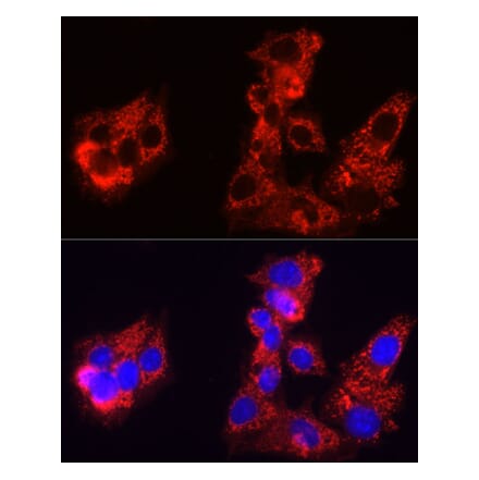 Immunofluorescence - Anti-Sorbitol Dehydrogenase Antibody (A308434) - Antibodies.com