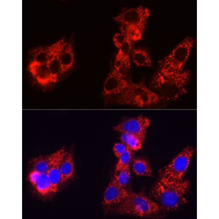 Immunofluorescence - Anti-Sorbitol Dehydrogenase Antibody (A308434) - Antibodies.com