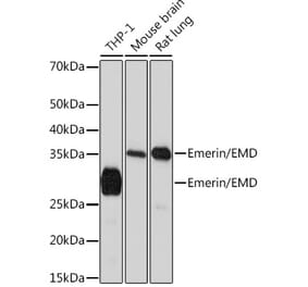 Western Blot - Anti-Emerin Antibody [ARC0921] (A308435) - Antibodies.com