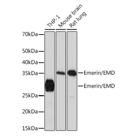 Western Blot - Anti-Emerin Antibody [ARC0921] (A308435) - Antibodies.com