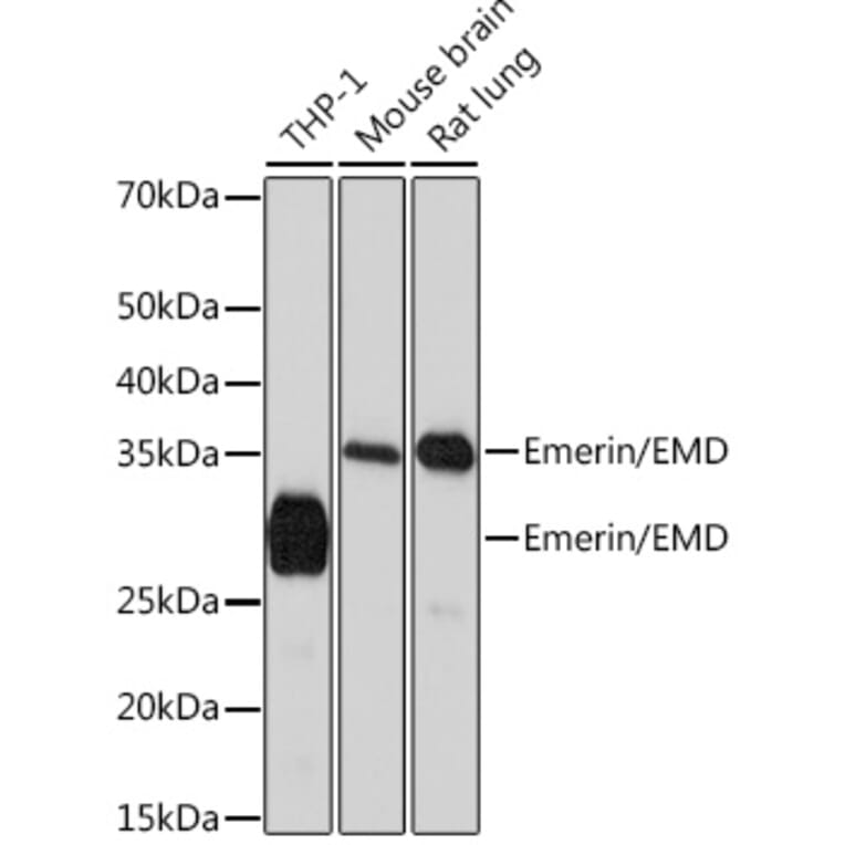 Western Blot - Anti-Emerin Antibody [ARC0921] (A308435) - Antibodies.com