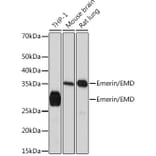 Western Blot - Anti-Emerin Antibody [ARC0921] (A308435) - Antibodies.com