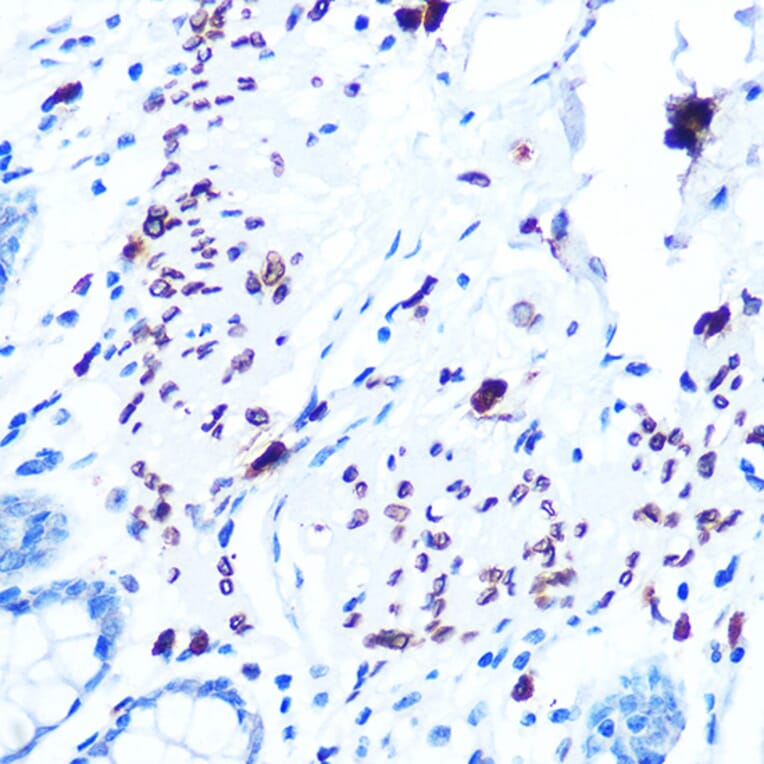 Immunohistochemistry - Anti-Emerin Antibody [ARC0921] (A308435) - Antibodies.com