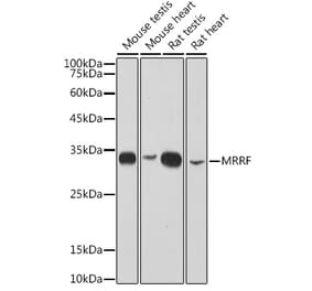 Western Blot - Anti-MRRF Antibody [ARC2589] (A308436) - Antibodies.com