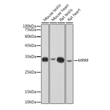 Western Blot - Anti-MRRF Antibody [ARC2589] (A308436) - Antibodies.com