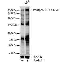 Western Blot - Anti-IP3 receptor (phospho Ser1756) Antibody (A308437) - Antibodies.com