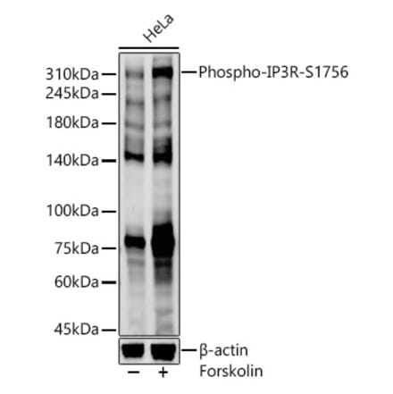 Western Blot - Anti-IP3 receptor (phospho Ser1756) Antibody (A308437) - Antibodies.com