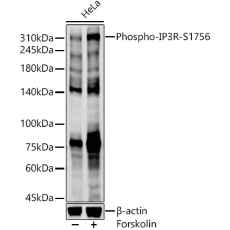 Western Blot - Anti-IP3 receptor (phospho Ser1756) Antibody (A308437) - Antibodies.com