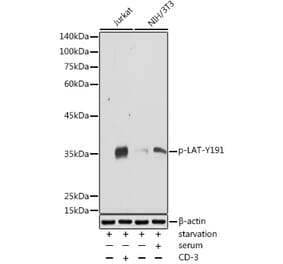 Western Blot - Anti-LAT (phospho Tyr191) Antibody (A308438) - Antibodies.com