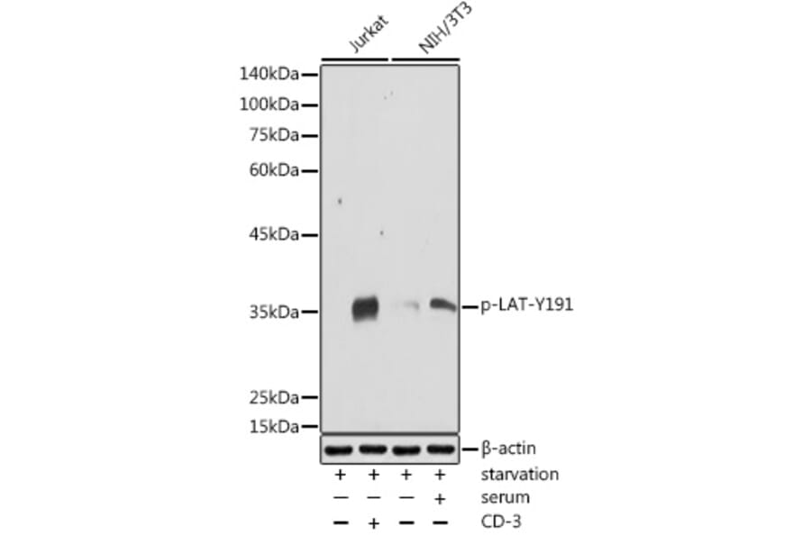 Western Blot - Anti-LAT (phospho Tyr191) Antibody (A308438) - Antibodies.com