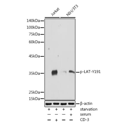 Western Blot - Anti-LAT (phospho Tyr191) Antibody (A308438) - Antibodies.com