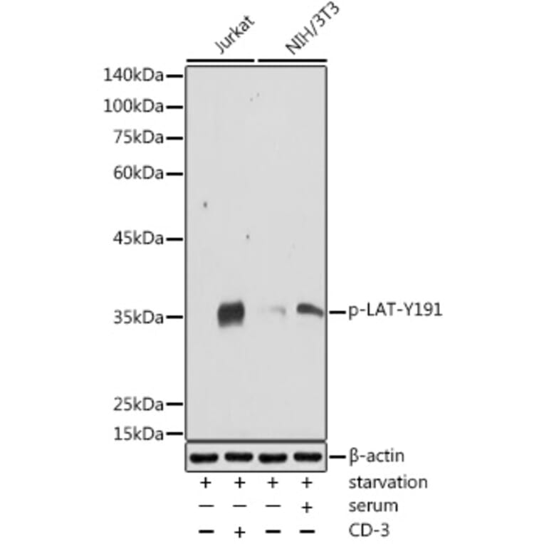 Western Blot - Anti-LAT (phospho Tyr191) Antibody (A308438) - Antibodies.com
