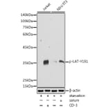 Western Blot - Anti-LAT (phospho Tyr191) Antibody (A308438) - Antibodies.com