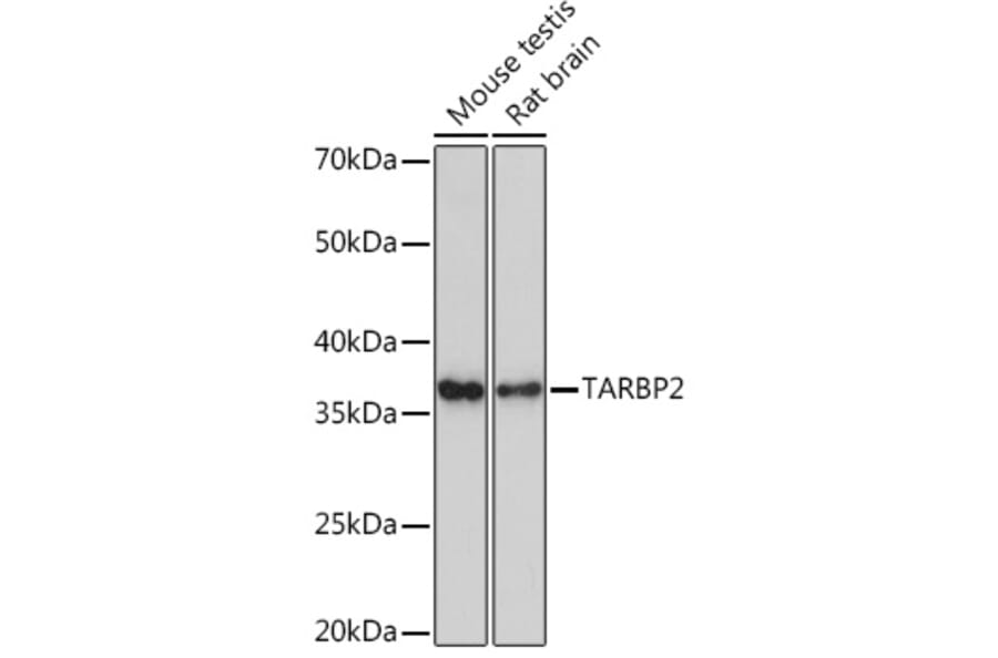 Western Blot - Anti-TRBP Antibody [ARC1792] (A308439) - Antibodies.com