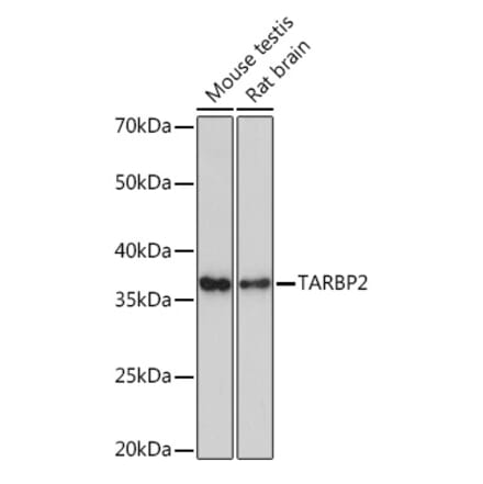 Western Blot - Anti-TRBP Antibody [ARC1792] (A308439) - Antibodies.com