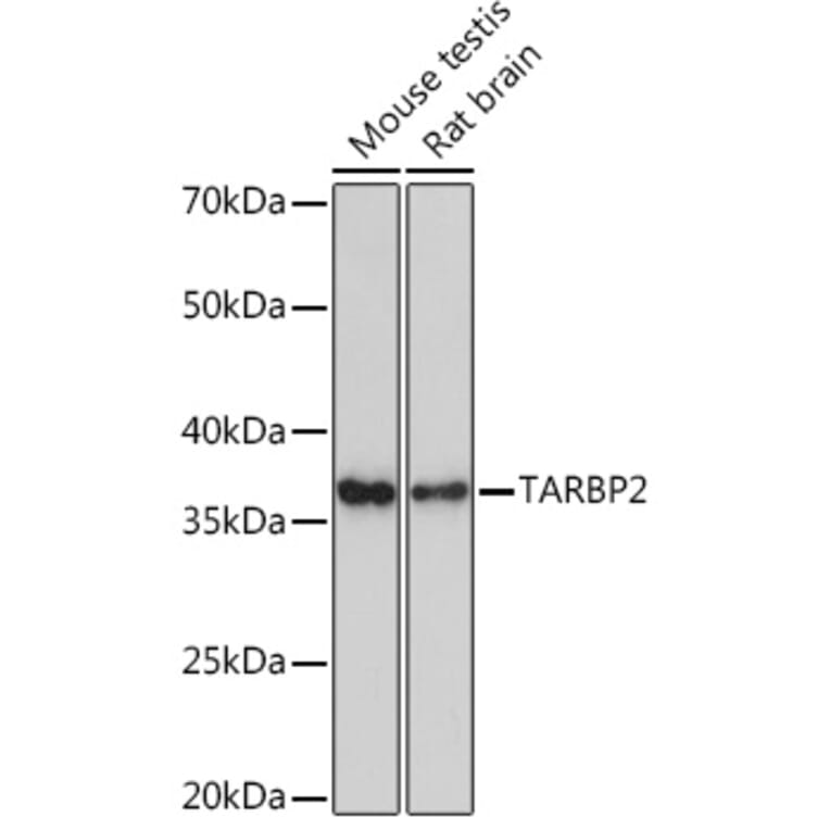 Western Blot - Anti-TRBP Antibody [ARC1792] (A308439) - Antibodies.com