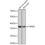 Western Blot - Anti-TRBP Antibody [ARC1792] (A308439) - Antibodies.com
