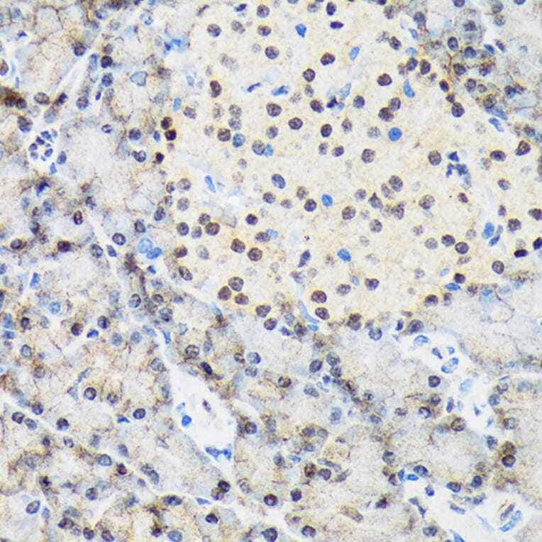 Immunohistochemistry - Anti-TRBP Antibody [ARC1792] (A308439) - Antibodies.com