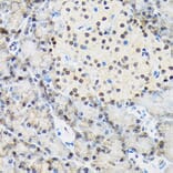 Immunohistochemistry - Anti-TRBP Antibody [ARC1792] (A308439) - Antibodies.com