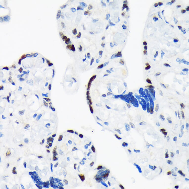 Immunohistochemistry - Anti-TRBP Antibody [ARC1792] (A308439) - Antibodies.com