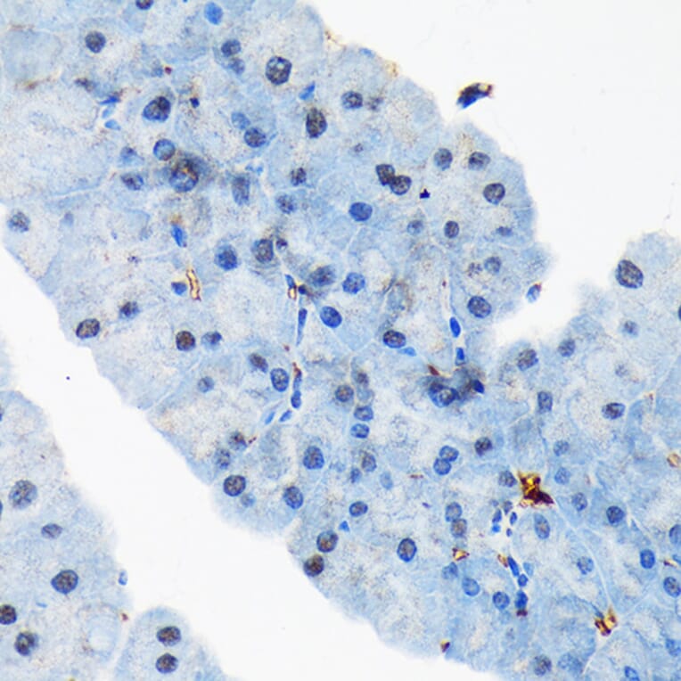Immunohistochemistry - Anti-TRBP Antibody [ARC1792] (A308439) - Antibodies.com