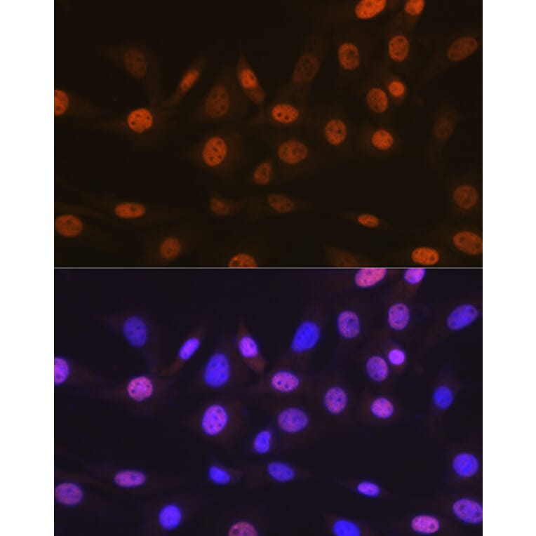 Immunofluorescence - Anti-TRBP Antibody [ARC1792] (A308439) - Antibodies.com