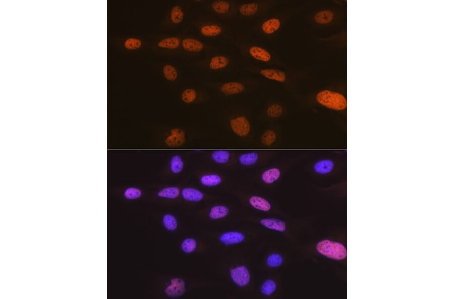 Immunofluorescence - Anti-TRBP Antibody [ARC1792] (A308439) - Antibodies.com