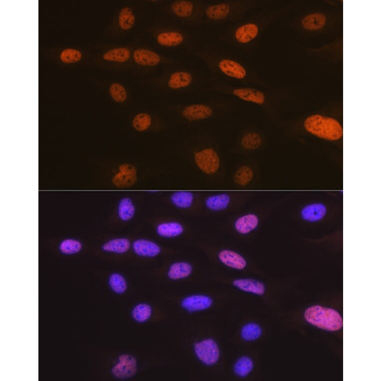 Immunofluorescence - Anti-TRBP Antibody [ARC1792] (A308439) - Antibodies.com