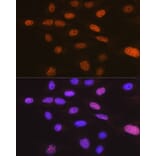 Immunofluorescence - Anti-TRBP Antibody [ARC1792] (A308439) - Antibodies.com