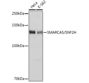 Western Blot - Anti-SNF2H Antibody [ARC0795] (A308440) - Antibodies.com