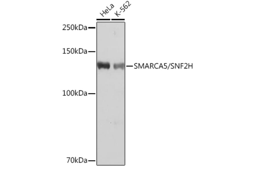 Western Blot - Anti-SNF2H Antibody [ARC0795] (A308440) - Antibodies.com