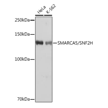 Western Blot - Anti-SNF2H Antibody [ARC0795] (A308440) - Antibodies.com