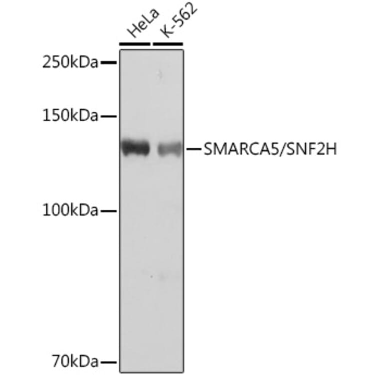 Western Blot - Anti-SNF2H Antibody [ARC0795] (A308440) - Antibodies.com