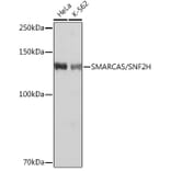 Western Blot - Anti-SNF2H Antibody [ARC0795] (A308440) - Antibodies.com