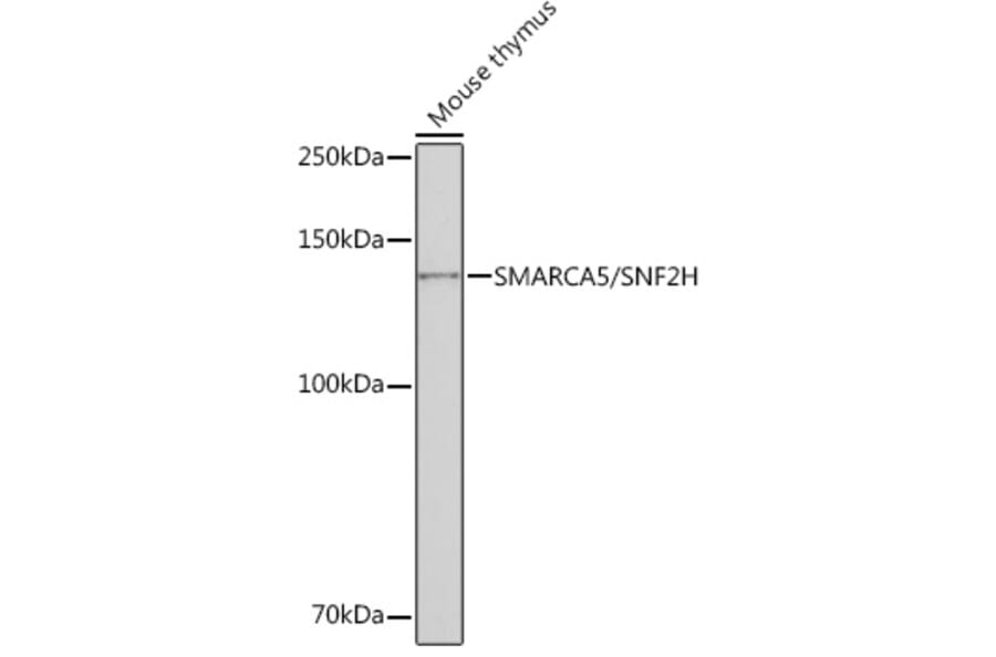 Western Blot - Anti-SNF2H Antibody [ARC0795] (A308440) - Antibodies.com