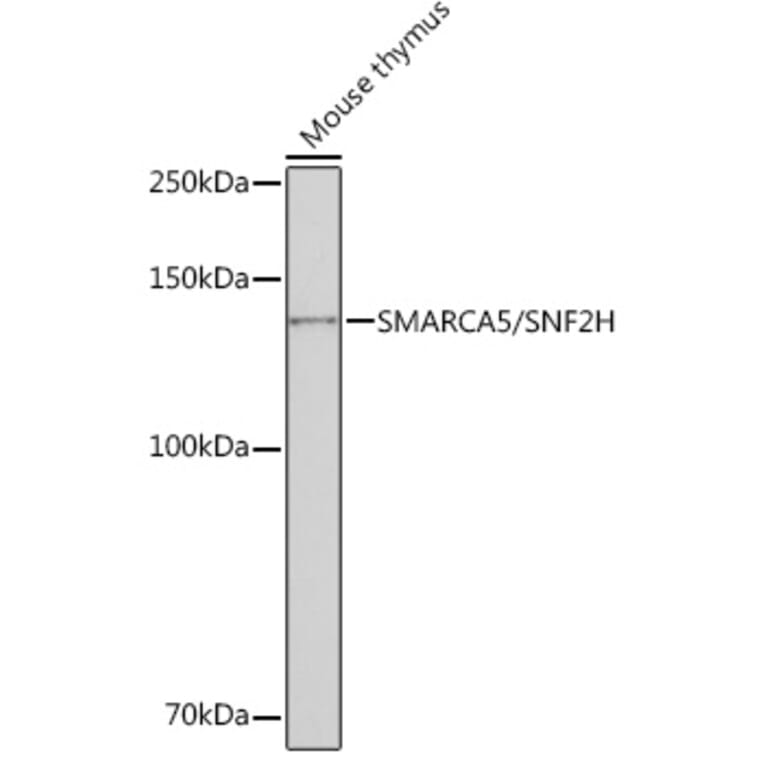 Western Blot - Anti-SNF2H Antibody [ARC0795] (A308440) - Antibodies.com