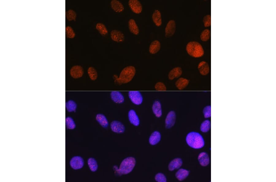 Immunofluorescence - Anti-SNF2H Antibody [ARC0795] (A308440) - Antibodies.com