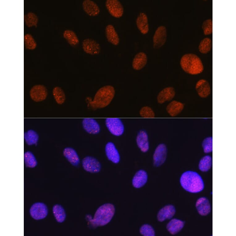 Immunofluorescence - Anti-SNF2H Antibody [ARC0795] (A308440) - Antibodies.com